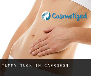 Tummy Tuck in Caerdeon