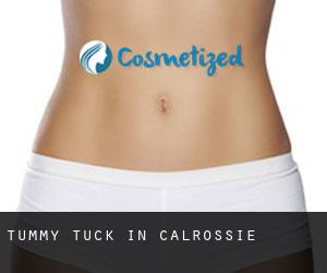 Tummy Tuck in Calrossie