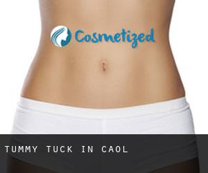 Tummy Tuck in Caol