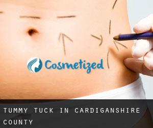 Tummy Tuck in Cardiganshire County