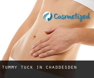 Tummy Tuck in Chaddesden Tummy Tuck in Chaddesden