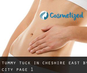 Tummy Tuck in Cheshire East by city - page 1