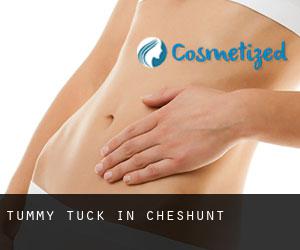 Tummy Tuck in Cheshunt Tummy Tuck in Cheshunt