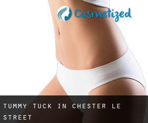 Tummy Tuck in Chester-le-Street