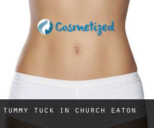 Tummy Tuck in Church Eaton