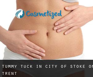 Tummy Tuck in City of Stoke-on-Trent Tummy Tuck in City of Stoke-on-Trent