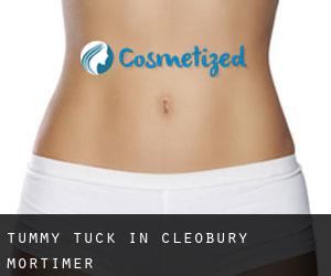 Tummy Tuck in Cleobury Mortimer