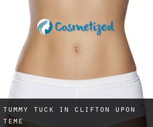 Tummy Tuck in Clifton upon Teme