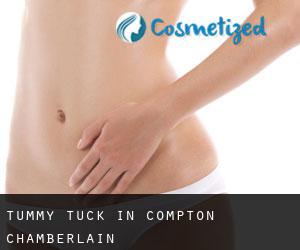 Tummy Tuck in Compton Chamberlain