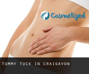 Tummy Tuck in Craigavon Tummy Tuck in Craigavon