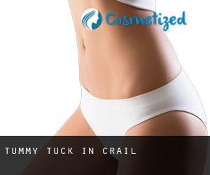 Tummy Tuck in Crail