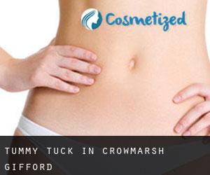 Tummy Tuck in Crowmarsh Gifford