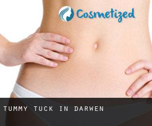 Tummy Tuck in Darwen