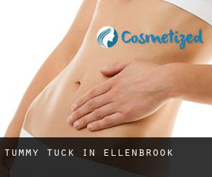 Tummy Tuck in Ellenbrook