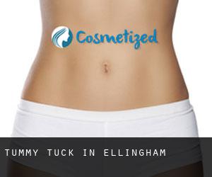 Tummy Tuck in Ellingham