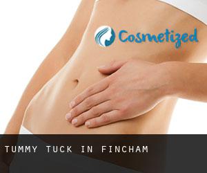 Tummy Tuck in Fincham