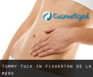 Tummy Tuck in Fisherton de la Mere