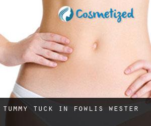 Tummy Tuck in Fowlis Wester