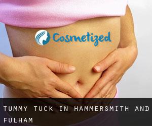 Tummy Tuck in Hammersmith and Fulham