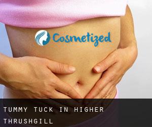 Tummy Tuck in Higher Thrushgill