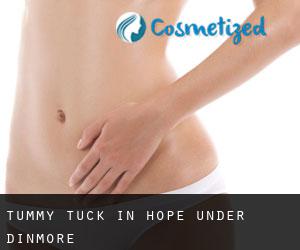Tummy Tuck in Hope under Dinmore