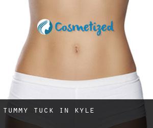 Tummy Tuck in Kyle