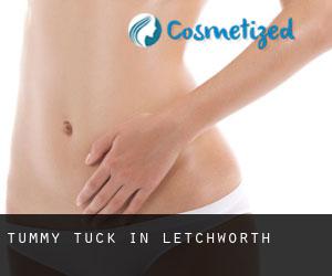 Tummy Tuck in Letchworth