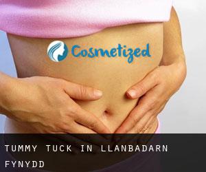 Tummy Tuck in Llanbadarn-fynydd