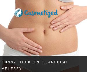 Tummy Tuck in Llanddewi Velfrey