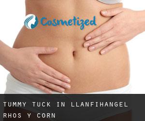 Tummy Tuck in Llanfihangel-Rhos-y-corn