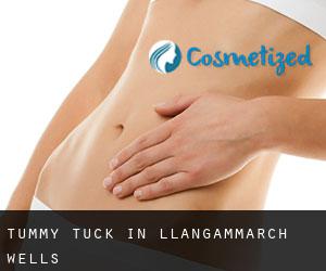 Tummy Tuck in Llangammarch Wells