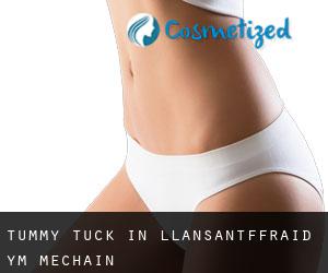 Tummy Tuck in Llansantffraid-ym-Mechain