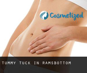 Tummy Tuck in Ramsbottom