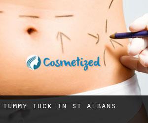 Tummy Tuck in St Albans